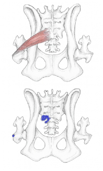 Piriformis