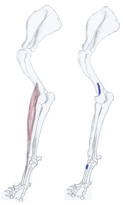Extensor carpi radialis