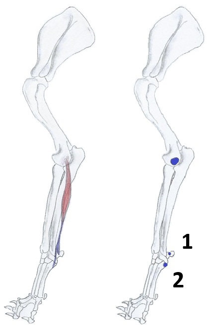Extensor carpi ulnaris