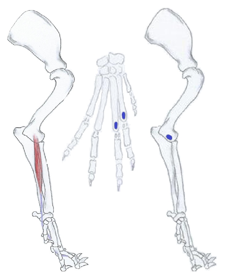 Flexor carpi radialis
