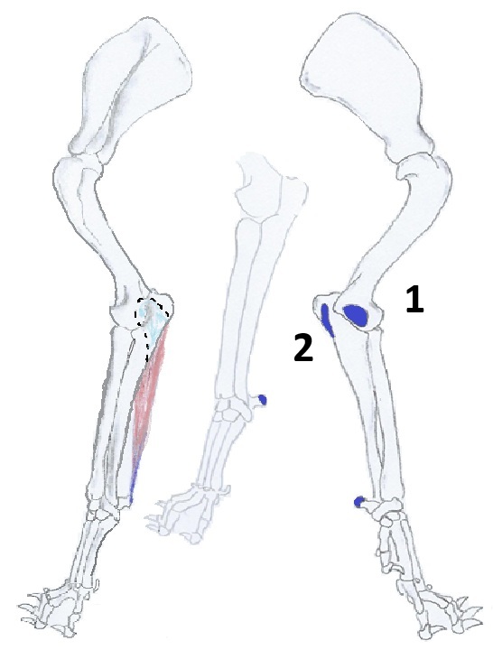 Flexor carpi ulnaris