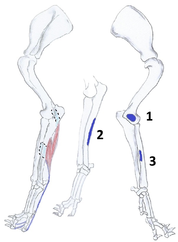 Flexor digitorum profundus