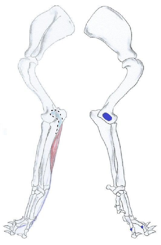 Flexor digitorum superficialis